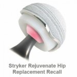 Stryker Hip Settlement